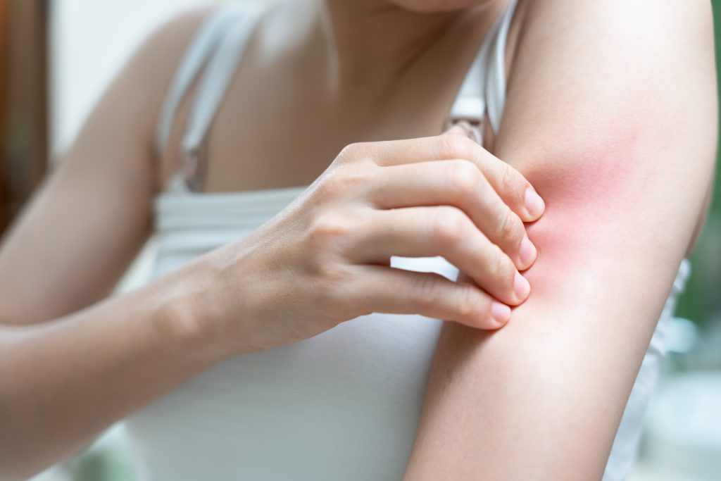 Femeie care își scarpină mâinile